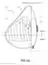 Fig. 07 - Tissue expanders and methods of use