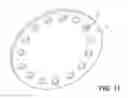 Fig. 12 - Tissue expanders and methods of use