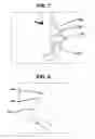Fig. 05 - Columellar strut for nasal tip support