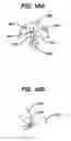 Fig. 07 - Columellar strut for nasal tip support