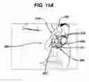 Fig. 08 - Columellar strut for nasal tip support