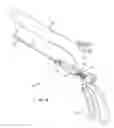 Fig. 02 - Systems, devices and methods for providing therapy to an anatomical structure using high frequency pressure waves and/or cryogenic temperatures