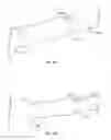 Fig. 41 - Systems, devices and methods for providing therapy to an anatomical structure using high frequency pressure waves and/or cryogenic temperatures
