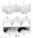 Fig. 09 - METHOD AND SYSTEM FOR CONSTRUCTING GEOMETRIC SKELETONS AND MEDIAL ZONES OF RIGID AND NON-RIGID SHAPES