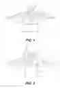 Fig. 02 - Cut resistant garment