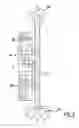 Fig. 04 - REMOTE CONTROL HANDLE