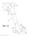 Fig. 07 - ANCHOR SYSTEM FOR FENCING