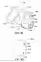 Fig. 85 - Adjustable mask system and related methods