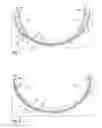 Fig. 02 - Method for creating a vacuum setup for producing a fiber composite part, and plunger used in the method