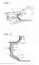 Fig. 02 - Method for producing a lightweight, sound insulating covering for motor vehicles and corresponding covering