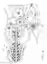 Fig. 06 - Selectively orientable implantable fastener cartridge