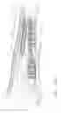 Fig. 178 - Staple cartridge comprising a layer