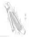 Fig. 197 - Staple cartridge comprising a layer