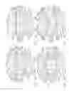 Fig. 26 - Staple cartridge comprising a layer