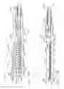 Fig. 71 - Fastener system comprising a plurality of connected retention matrix elements