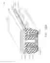 Fig. 167 - Surgical stapler anvil comprising a plurality of forming pockets