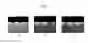 Fig. 08 - Methods for forming gates in gate-last processes and gate areas formed by the same