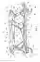 Fig. 02 - Front-axle bracket for motor vehicles