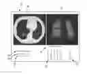 Fig. 01 - Visualization apparatus for visualizing an image data set