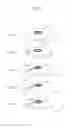 Fig. 06 - Method for manufacturing lens for electronic spectacles, lens for electronic spectacles, and electronic spectacles