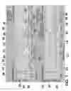 Fig. 02 - Method and apparatus for corrective secondary saccades analysis with video oculography system