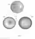 Fig. 08 - Imaging of macular pigment distributions