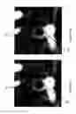 Fig. 07 - Method for visualization of airway anatomical changes