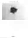 Fig. 06 - Colonization factor (CF) antigens of enterotoxigenic escherichia coli in recombinant bacteria