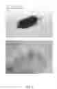 Fig. 09 - Colonization factor (CF) antigens of enterotoxigenic escherichia coli in recombinant bacteria