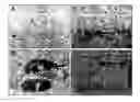Fig. 01 - PERIVASCULAR MESENCHYMAL PRECURSOR CELLS