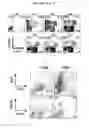 Fig. 02 - In Vitro Generation of Myeloid Derived Suppressor Cells
