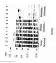 Fig. 04 - USE OF PROTEINS AND PEPTIDES ENCODED BY THE GENOME OF A NOVEL SARS-ASSOCIATED CORONAVIRUS STRAIN
