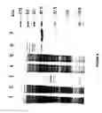 Fig. 06 - USE OF PROTEINS AND PEPTIDES ENCODED BY THE GENOME OF A NOVEL SARS-ASSOCIATED CORONAVIRUS STRAIN