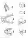 Fig. 02 - Orthodontic braces