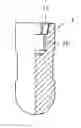 Fig. 01 - Dental implants