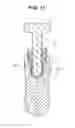 Fig. 08 - Dental implants