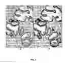 Fig. 02 - Antibody cocktail