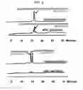 Fig. 07 - Diagnostic method for celiac sprue