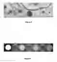 Fig. 04 - METHODS FOR IN VITRO CANCER CELL DETECTION, DIAGNOSIS AND THERAPY USING MULTIDOMAIN BIOTAGS