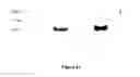 Fig. 16 - METHODS FOR IN VITRO CANCER CELL DETECTION, DIAGNOSIS AND THERAPY USING MULTIDOMAIN BIOTAGS