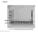 Fig. 08 - Basic protein purification tags from thermophilic bacteria