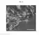 Fig. 03 - Human embryonic stem cell line prepared by nuclear transfer of a human somatic cell into an enucleated human oocyte