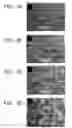 Fig. 07 - Ex host maturation of germline stem cells