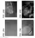 Fig. 43 - Ex host maturation of germline stem cells