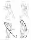 Fig. 04 - PASSIVE HAND MOVE SWING AID DEVICE FOR GOLF AND BASEBALL