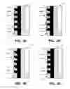 Fig. 04 - Putter heads and putters