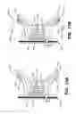 Fig. 13 - Putter heads and putters