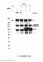 Fig. 03 - Compositions containing HC-HA complex and methods of use thereof