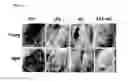 Fig. 07 - PHARMACEUTICAL COMPOSITION FOR PROMOTING THE HEALING OF WOUNDS AND CONTAINING LYSOPHOSPHATIDIC ACID AND AN ADENYLYL CYCLASE INHIBITOR AS ACTIVE INGREDIENTS