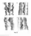 Fig. 09 - MODULATION OF INFLAMMATORY RESPONSES BY FACTOR XI